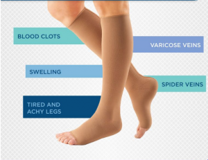 Varicose socks for the treatment of leg pain and the correct way of ...