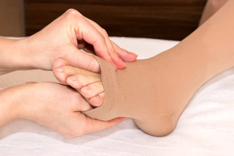 استفاده از جوراب‌های مخصوص واریس در درمان خانگی واریس